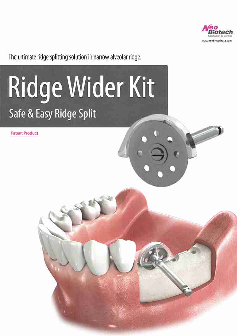 RIDGE WIDER KIT