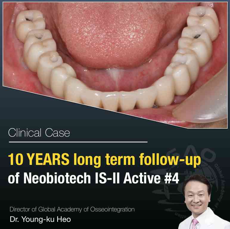 10 YEARS <BR> FOLLOW UP - 4