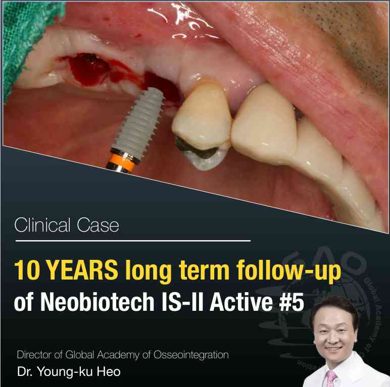 10 YEARS <BR> FOLLOW UP - 5