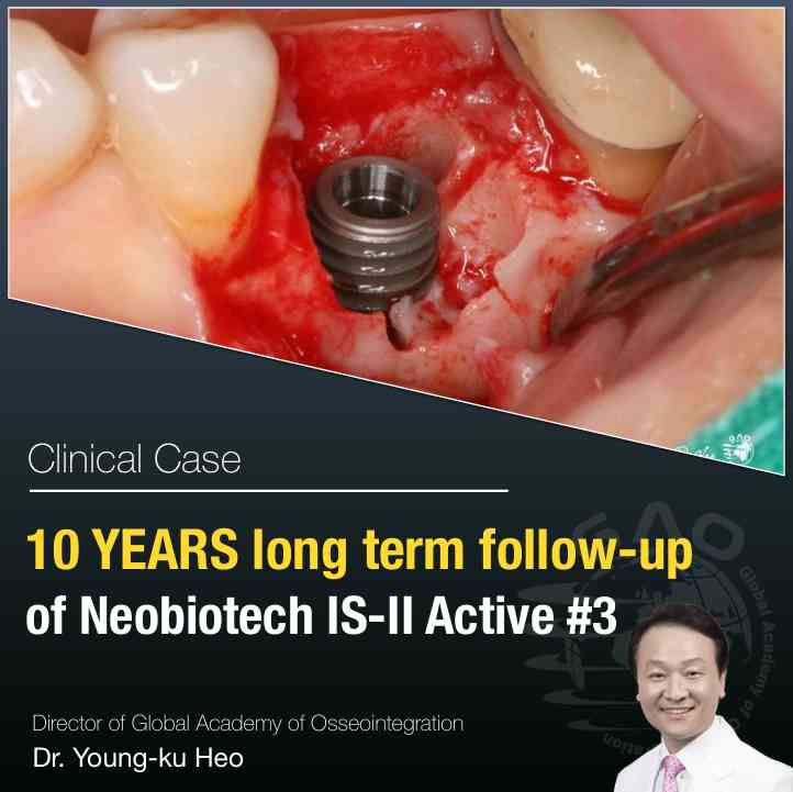 10 YEARS <BR> FOLLOW UP - 3