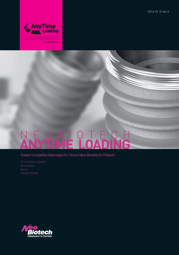 ANYTIME LOADING